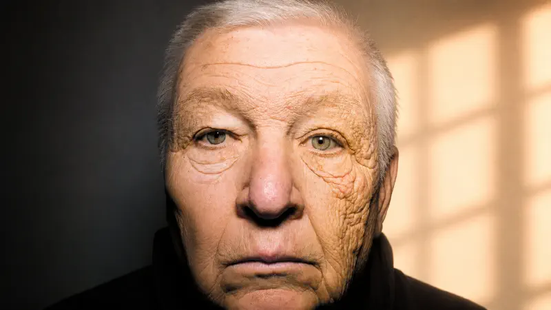 দীর্ঘদিনের ড্রাইভারের মুখে একপাশের photoaging